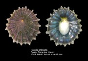 Patella ordinaria